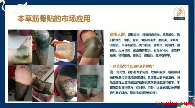 謝藥師本草筋骨貼的市場應(yīng)用及適用人群